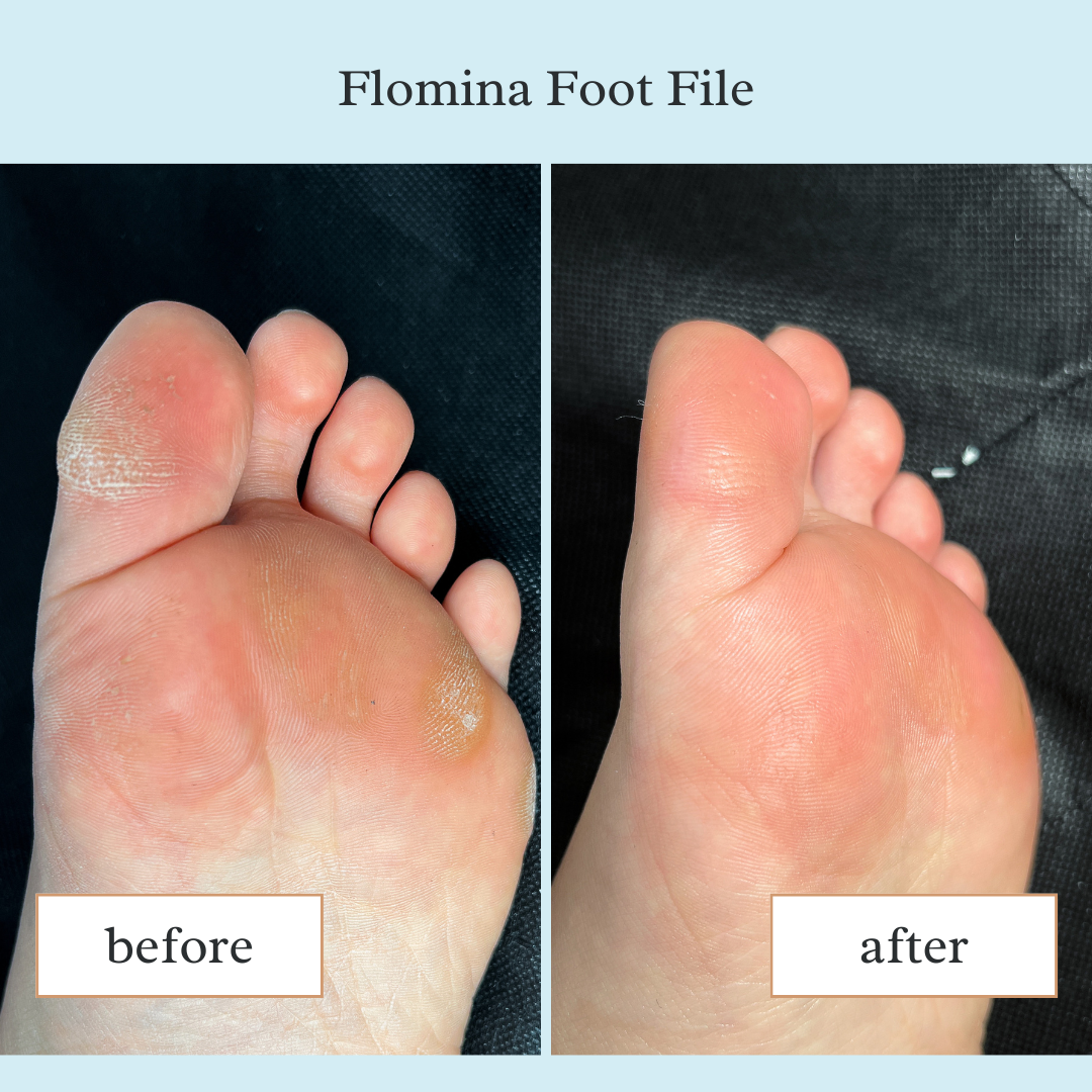 Flomina Glass Footfile Bundle (Coarse + Fine)